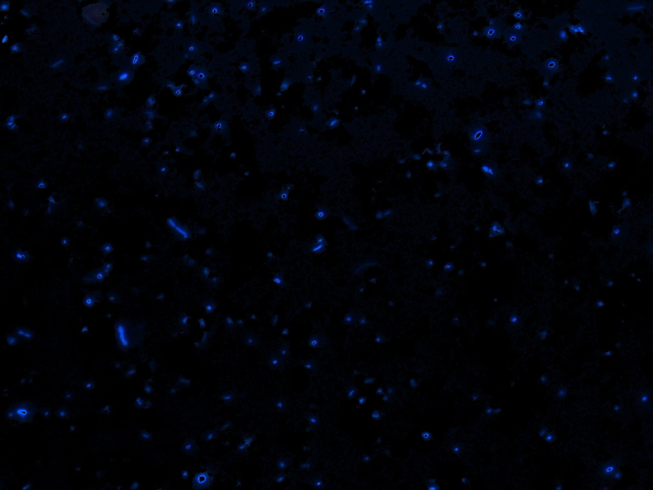 Bacteria-LayerMaskWithThresholdedHue.jpg