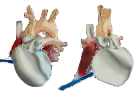 corazon convertilo en metal.png